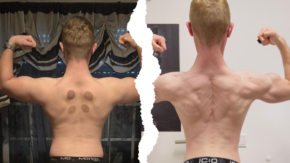 Aluno de costas em duplo bíceps, antes e depois